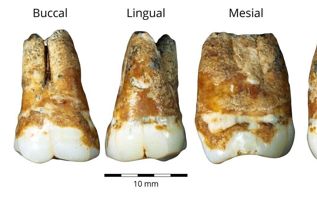 Molaires supérieures et inférieures trouvées dans la grotte de Manot, vieilles de 38 000 ans et qui montrent un mélange de caractéristiques (Crédit : Dr. Rachel Sarig)