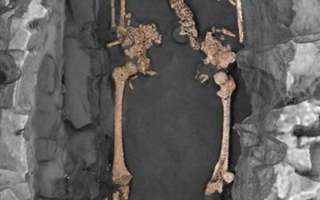 Vue zénithale 3D de la sépulture individuelle S30. L’individu est un adulte féminin, inhumé sur le dos avec les membres supérieurs en extension le long du corps et selon une orientation ouest-est. Deux pierres encadrent le crâne. La décomposition du corps s’est effectuée en espace vide. (Crédit : Philippe Blanchard/H. Holzem/Inrap)