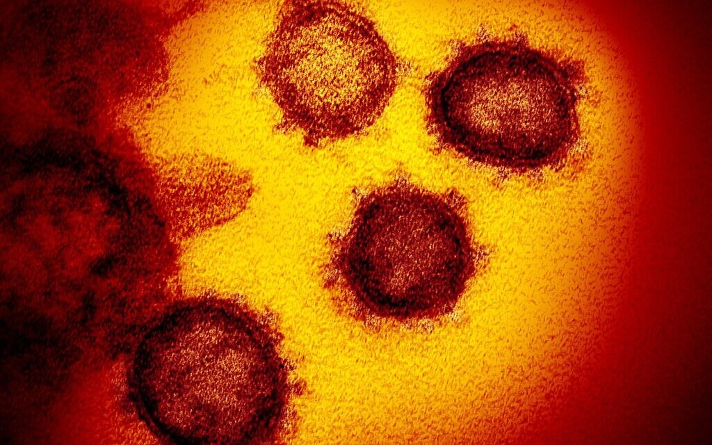 Cette image de microscope électronique en transmission montre le SRAS-CoV-2, le virus qui provoque la COVID-19, isolé chez un patient aux États-Unis, émergeant de la surface des cellules cultivées en laboratoire. (NIAID-RML / Wikipedia) Cette image de microscope électronique en transmission montre le SRAS-CoV-2, le virus qui provoque la COVID-19, isolé chez un patient aux États-Unis, émergeant de la surface des cellules cultivées en laboratoire. (NIAID-RML / Wikipedia)