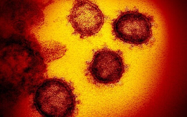 Cette image de microscope électronique en transmission montre le SRAS-CoV-2, le virus qui provoque la COVID-19, isolé chez un patient aux États-Unis, émergeant de la surface des cellules cultivées en laboratoire. (NIAID-RML / Wikipedia) Cette image de microscope électronique en transmission montre le SRAS-CoV-2, le virus qui provoque la COVID-19, isolé chez un patient aux États-Unis, émergeant de la surface des cellules cultivées en laboratoire. (NIAID-RML / Wikipedia)