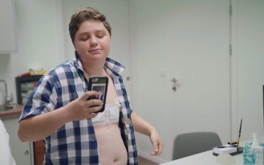 Ofri Shemesh après une chirurgie d'ablation des seins dans ‘Transkids’ (Medalia Productions)