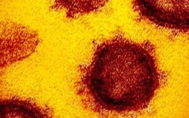Vue au microscope électronique du SRAS-CoV2, le virus qui provoque la COVID-19, isolé chez un patient aux États-Unis, émergeant de la surface des cellules cultivées en laboratoire. (NIAID-RML / Wikipédia)