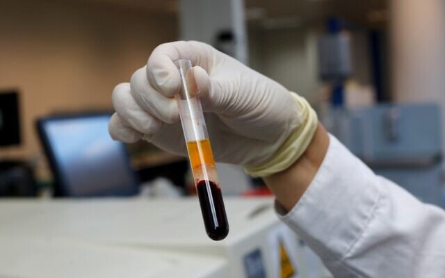 Un laborantin israélien tient un échantillon sanguin pendant des tests sérologiques dans un laboratoire de l'organisation Leumit à Or Yehuda, près de Tel Aviv, le 29 juin 2020 (Crédit : GIL COHEN-MAGEN / AFP) Un laborantin israélien tient un échantillon sanguin pendant des tests sérologiques dans un laboratoire de l'organisation Leumit à Or Yehuda, près de Tel Aviv, le 29 juin 2020 (Crédit : GIL COHEN-MAGEN / AFP)