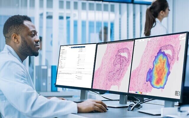 L'entreprise israélienne Ibex Medical Analytics a créé un logiciel de diagnostic du cancer reposant sur l'IA. (Autorisation) L'entreprise israélienne Ibex Medical Analytics a créé un logiciel de diagnostic du cancer reposant sur l'IA. (Autorisation)