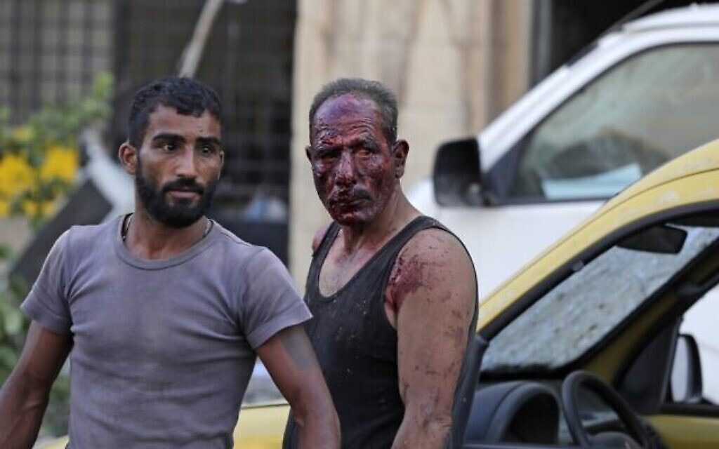 Des blessés marchent aux abords du site de l'explosion survenue à Beyrouth, le 4 août 2020. (Crédit : ANWAR AMRO / AFP)