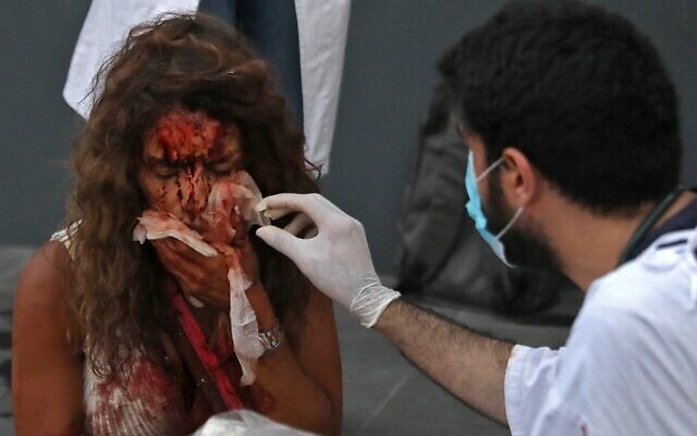 Un médecin soigne les blessures d'une femme devant un hôpital à la suite d'une explosion dans la capitale libanaise Beyrouth, le 4 août 2020. (IBRAHIM AMRO / AFP)