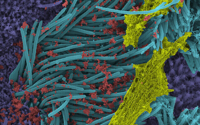Une image obtenue par des chercheurs américains montre des particules du virus SRAS-CoV-2 (en rouge), recouvrant les cils bronchiques humains (en bleu) et le mucus (en jaune). (Ehre Lab, Facutlé de médecine, UNC)