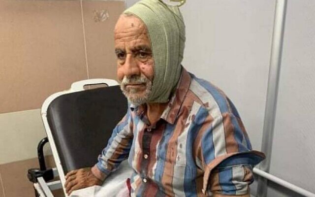 Un Palestinien âgé de 72 ans pris en charge à l'hôpital suite à une attaque présumée des habitants d'implantation. (Crédit : Conseil local de Niilin)