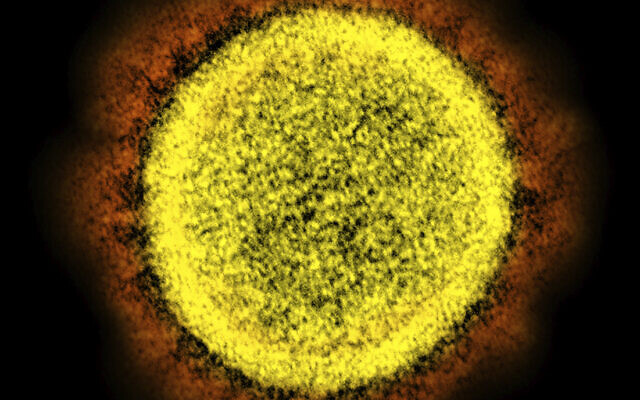 Image au microscope électronique d'une particule  SARS-CoV-2 du nouveau coronavirus chez un malade transmise par le Centre national des allergies et des maladies infectieuses américain (Crédit : NIAID/NIH via AP)