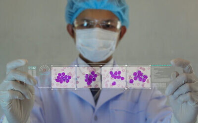 Illustration : une image d'octor de cellules leucémiques. (kukhunthod via iStock Getty Images)