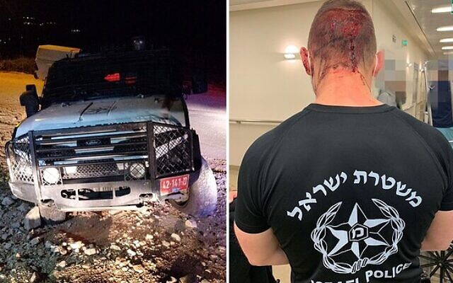 Un véhicule de la police ayant reçu des jets de pierre de la part de participants à un mariage illégal aux abords d'Itamar, en Cisjordanie ; et l'un des agents blessés légèrement lors de la dispersion de la cérémonie, le 11 février 2020. (Crédit : Police israélienne) Un véhicule de la police ayant reçu des jets de pierre de la part de participants à un mariage illégal aux abords d'Itamar, en Cisjordanie ; et l'un des agents blessés légèrement lors de la dispersion de la cérémonie, le 11 février 2020. (Crédit : Police israélienne)