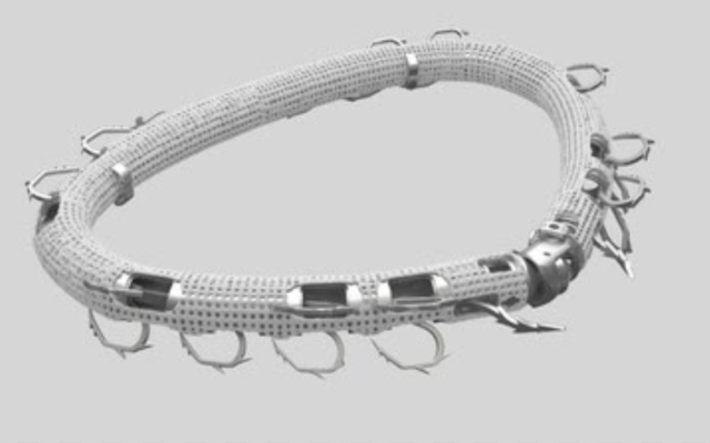 L'anneau d'annuloplastie transseptal AMEND. (Crédit : Valcare Medical)