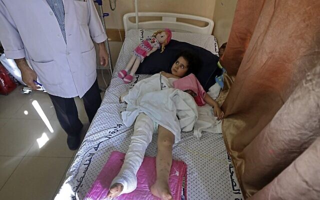 Un enfant palestinien, blessé lors des frappes aériennes israéliennes sur la bande de Gaza, soigné à l'hôpital Al-Shifa dans l'enclave palestinienne, le 19 mai 2021. (Crédit : MAHMUD HAMS/AFP) Un enfant palestinien, blessé lors des frappes aériennes israéliennes sur la bande de Gaza, soigné à l'hôpital Al-Shifa dans l'enclave palestinienne, le 19 mai 2021. (Crédit : MAHMUD HAMS/AFP)