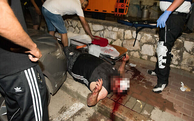 Un homme blessé lors d'affrontements entre Arabes et Juifs à Akko, dans le nord d'Israël, le 12 mai 2021. (Crédit : Roni Ofer/Flash90)