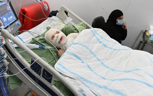 Muhammad, 12 ans, qui a été blessé par une bombe artisanale, vendredi, sur son domicile de Haïfa, dans son lit de l'hôpital Sheba. (Autorisation : Centre médical Sheba)