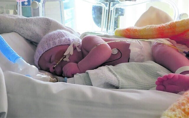 Alta Fixsler dans un hôpital de Manchester, en Angleterre, en 2019. (Autorisation de la famille via JTA) Alta Fixsler dans un hôpital de Manchester, en Angleterre, en 2019. (Autorisation de la famille via JTA)