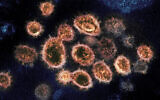 Particules du virus SRAS-CoV-2, à l'origine du COVID-19, isolées chez un patient aux États-Unis, émergeant de la surface de cellules cultivées en laboratoire. (Crédit : NIAID-RML via AP) 