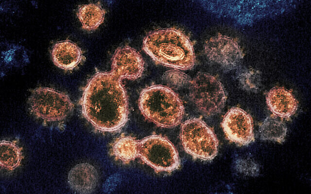 Particules du virus SRAS-CoV-2, à l'origine du COVID-19, isolées chez un patient aux États-Unis, émergeant de la surface de cellules cultivées en laboratoire. (Crédit : NIAID-RML via AP) Particules du virus SRAS-CoV-2, à l'origine du COVID-19, isolées chez un patient aux États-Unis, émergeant de la surface de cellules cultivées en laboratoire. (Crédit : NIAID-RML via AP)