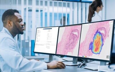 Ibex Medical Analytics est un fabricant israélien de logiciels de diagnostic du cancer basés sur l'IA. (Crédit : autorisation)