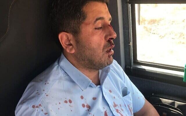 Le chauffeur de bus Muhammad Kak a été agressé près de la ville cisjordanienne de Shvut Rachel, le 13 août 2021. (Autorisation)