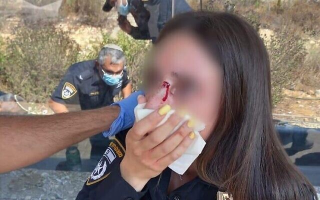 Une policière israélienne blessée lors d'une altercation avec un homme qui refusait de porter un masque conformément aux ordres sanitaires relatifs au coronavirus, à Jérusalem, le 1er septembre 2021. (Crédit : Police israélienne)