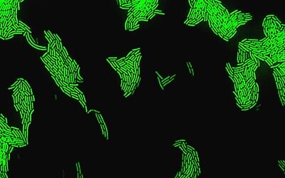 Bactéries sortant de l'état "chaotique" récemment découvert, dans un laboratoire de l'Université hébraïque. (Crédit : Université hébraïque/Orit Gefen/Yoav Kaplan)