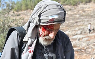 Le rabbin de gauche Arik Ascherman après une attaque présumée des habitants israéliens d'implantation près de Bat Yin, en Cisjordanie, le 12 novembre 2021. (Crédit : Shai Kendler)