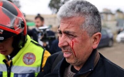 Le photographe AP Mahmoud Illean après avoir été frappé par les forces de sécurité israéliennes lors de la couverture d'une manifestation dans le quartier de Sheikh Jarrah à Jérusalem-Est, le 17 décembre 2021. (AHMAD GHARABLI/AFP)