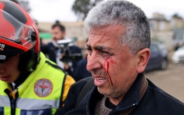 Le photographe AP Mahmoud Illean après avoir été frappé par les forces de sécurité israéliennes lors de la couverture d'une manifestation dans le quartier de Sheikh Jarrah à Jérusalem-Est, le 17 décembre 2021. (AHMAD GHARABLI/AFP) Le photographe AP Mahmoud Illean après avoir été frappé par les forces de sécurité israéliennes lors de la couverture d'une manifestation dans le quartier de Sheikh Jarrah à Jérusalem-Est, le 17 décembre 2021. (AHMAD GHARABLI/AFP)