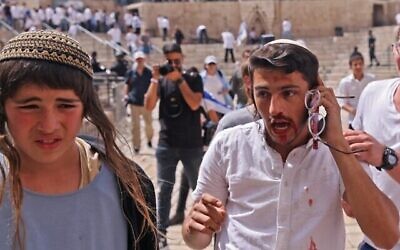 Un Israélien parle au téléphone, blessé  lors d'affrontements avec des Palestiniens à la Porte de Damas, à Jérusalem, le 29 mai 2022. (Crédit : Ahmad Gharabli/AFP)