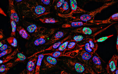 Immunofluorescence des cellules cancéreuses par imagerie fluorescente  en 2D avec les noyaux (spécifiquement l’ADN) en bleu, le cytoplasme (le liquide gélatineux qui remplit la cellule) en rouge, et les dommages causés à l’ADN en vert. (Crédit : Nicola Ferrari via iStock par Getty Images)