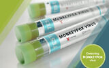 Un test développé par R-Biopharm à des fins de recherche pour suivre et contrôler la propagation du virus de la variole du singe, le 1er juin 2022. (Crédit: R-Biopharm AG/news aktuell via AP Images)