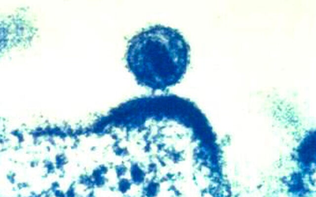 Un seul virus de l'immunodéficience humaine (VIH) bourgeonne à partir d'une cellule immunitaire humaine, que le virus a infectée, et à l'intérieur de laquelle le VIH s'est répliqué. (Crédit: NIAID via AP)
