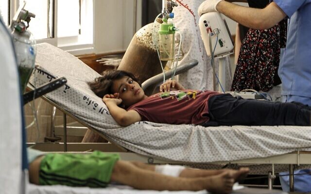 Un enfant palestinien blessé à la suite de frappes aériennes israéliennes reçoit des soins à l'hôpital al-Shifa, dans la ville de Gaza, le 6 août 2022. (Crédit : Mahmud HAMS / AFP) Un enfant palestinien blessé à la suite de frappes aériennes israéliennes reçoit des soins à l'hôpital al-Shifa, dans la ville de Gaza, le 6 août 2022. (Crédit : Mahmud HAMS / AFP)