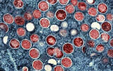 Une micrographie électronique à transmission colorisée de particules de mpox - anciennement variole du singe - (rouge) trouvées dans une cellule infectée (bleu), cultivée en laboratoire à l'Integrated Research Facility (IRF) du NIAID, à Fort Detrick, dans le Maryland. (Crédit : National Institute of Allergy and Infectious Diseases via AP)