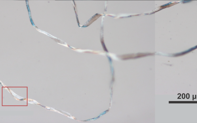 Des restes microscopiques de coton qui ont été découverts à Tel Tsaf, à l'aide d'une analyse de micro-vestiges. (Autorisation :  Université de Haïfa)