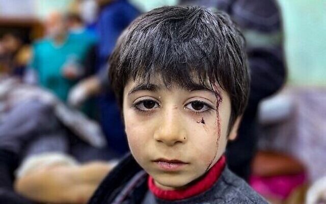 Un enfant blessé attend d'être soigné à l'hôpital de Bab al-Hawa après un tremblement de terre, dans la campagne du nord de la province syrienne d'Idlib, tenue par les rebelles, à la frontière avec la Turquie, le 6 février 2023. (Crédit : Aaref WATAD/AFP)