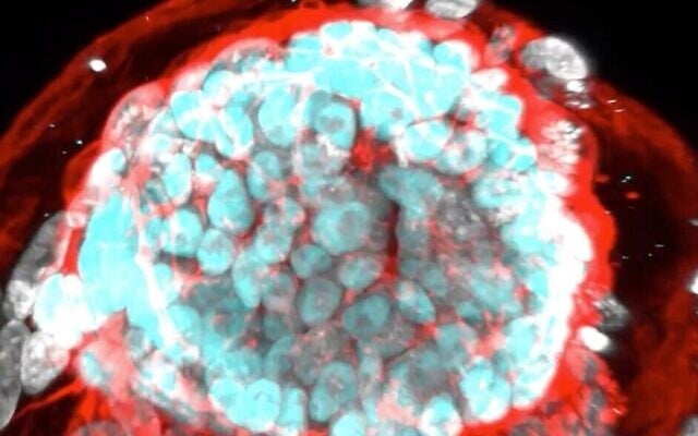 Imagerie numérique d'embryons dérivés de cellules souches créés par des scientifiques de l'Institut Weizmann des sciences en juin 2023. (Crédit : Capture d'écran/Institut Weizmann des sciences)