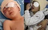 Images de Khaled Malalha, âgé de cinq ans, après l'ablation de son œil. (Crédit : Autorisation - utilisées conformément à l'article 27a de la loi sur le droit d'auteur)