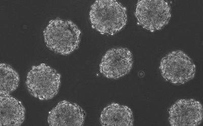 Image de phase d’embryoïdes en culture. (Crédit : Stemcellscientist / CC BY-SA 3.0)