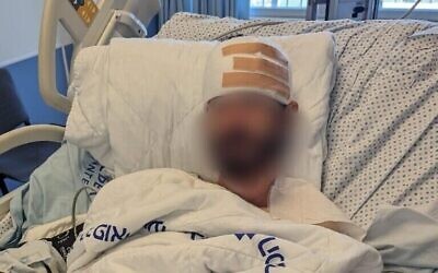 Yehiel Indore, soupçonné d'avoir tué un Palestinien de 19 ans, Qusai Jamal Matan, dans le village de Burqa en Cisjordanie, dans un hôpital de Jérusalem après avoir été blessé lors de l'affrontement, en août 2023. (Crédit : Honenu)