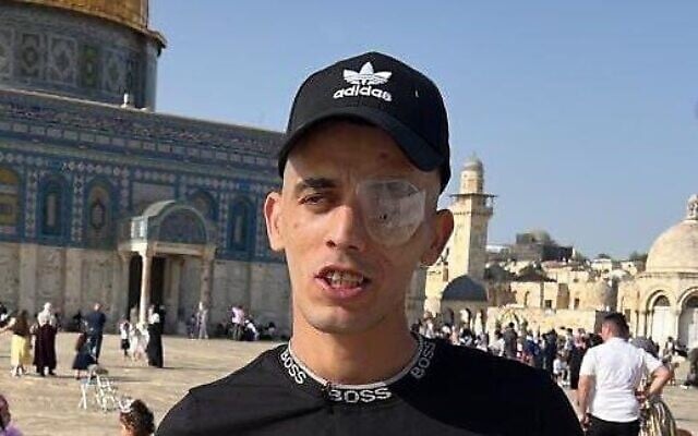 Hamza Abu Sneineh, 30 ans, blessé par une balle en caoutchouc tirée par la police israélienne lors des affrontements de la nuit du 7 mai 2021 sur le mont du Temple à Jérusalem. (Crédit : Capture d'écran Twitter ; utilisée conformément à l'article 27a de la loi sur le droit d'auteur)
