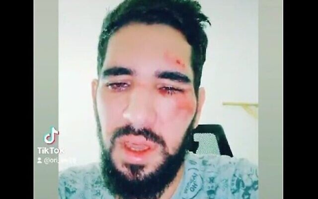 Ori Lev, 31 ans, agressé à l'extérieur d'un bar dans la ville centrale de Rehovot, le 18 août 2023. (Crédit : Capture d'écran de la vidéo TikTok ; utilisée conformément à l'article 27a de la loi sur le droit d'auteur) Ori Lev, 31 ans, agressé à l'extérieur d'un bar dans la ville centrale de Rehovot, le 18 août 2023. (Crédit : Capture d'écran de la vidéo TikTok ; utilisée conformément à l'article 27a de la loi sur le droit d'auteur)