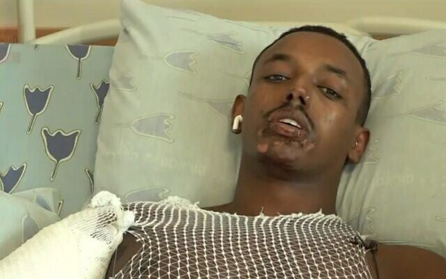 Fekadu Abera devant les caméras de la Douzième chaîne depuis son lit d'hôpital à Tel Aviv, le 3 septembre 2023. (Capture d'écran : Douzième chaîne, used in accordance with Clause 27a of the Copyright Law)