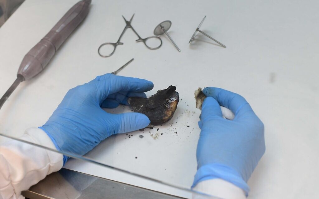 Un fragment d'os carbonisé provenant d'une victime non identifiée de l'attaque meurtrière du Hamas sur les communautés du sud d'Israël le 7 octobre 2023 est examiné au Centre national de médecine légale (Abu Kabir) à Jaffa, le 16 octobre 2023. (Crédit : Tomer Neuberg/Flash90)