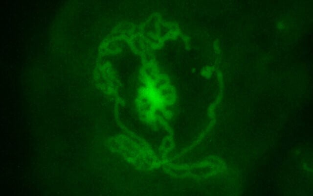 Une image fluorescente d'un organoïde testiculaire créé à partir d'embryons de souris et incubé dans une boîte pendant 14 jours dans le laboratoire de la Dr. Nitzan Gonen, à l'Université de Bar Ilan. (Crédit : Cheli Lev