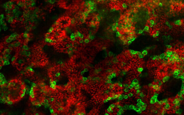 Des organoïdes testiculaires générés à partir de souriceaux et incubés dans une boîte pendant 21 jours dans le laboratoire de la Dr. Nitzan Gonen, à l'Université de Bar Ilan. (Crédit : Aviya Stopel)