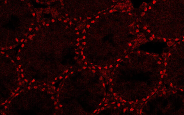 Une image de vrais testicules de souris de 28 jours créés dans le laboratoire de la Dr. Nitzan Gonen, à l'Université de Bar Ilan (Crédit : Aviya Stopel)