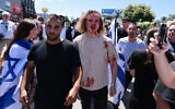 Un partisan d'Israël avec du sang sur le visage après avoir affronté des manifestants anti-Israël qui bloquaient l'accès à la synagogue orthodoxe Adas Torah, à Los Angeles, le 23 juin 2024. (Crédit : David Swanson/AFP)