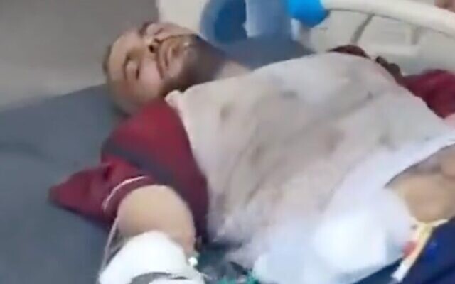 Amin Abed, 35 ans, un Gazaoui critique du Hamas, sur une civière après une agression faite par hommes masqués armés de couteaux et de matraques, le 8 juillet 2024. (Capture d'écran : X/used in accordance with Clause 27a of the Copyright Law) Amin Abed, 35 ans, un Gazaoui critique du Hamas, sur une civière après une agression faite par hommes masqués armés de couteaux et de matraques, le 8 juillet 2024. (Capture d'écran : X/used in accordance with Clause 27a of the Copyright Law)